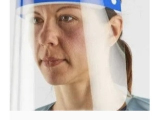 lot 400153 image: Chemical Splash Face Shield PPE Face Protection 10 Pack
