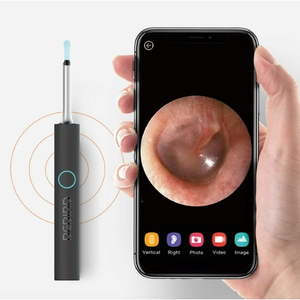 lot 180206 image: Bebird W3 Ear Cleaning Otoscope System