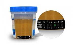 lot 5089 image: Urine Test Cups