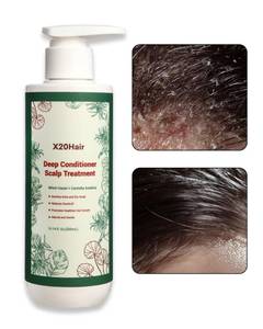 lot 65250 image: APPEARS NEW - X20Hair Deep Conditioner Scalp Treatment for Folliculitis - Relieves Dandruff, Psoriasis, Dryness & Itchiness, Balances Oil, Ideal for Women
