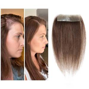 lot 2103 image: Meiverah scar human hair replacement Accidental burns without hair for men women Hairline Loss Straight Tape in Replacement Toupee (Medium Brown, 0.78x3)