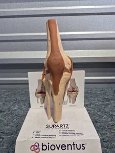 lot 202 image: Bioventus Supartz Knee Joint Anatomical Model - Retail $45