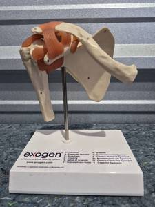 lot 216 image: Exogen Shoulder Joint Anatomical Model - Retail $85