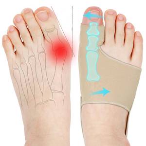 lot 10026 image: KTSAY Bunion Corrector for Women, Big Toe Straightener with Splint & Pads, Breathable for Day Support(2, Beige)