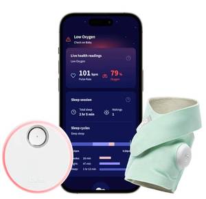 lot 34857 image: Owlet Dream Sock - Smart Baby Monitor View Heart Rate and Average Oxygen O2 as Sleep Quality Indicators. Wakings, Movement, and Sleep State. Digital Sleep Coach and Sleep Assist Prompts - Retail $299