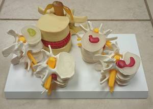 lot 281 image: Medical Spine Anatomy Model Set with Vertebrae and Discs