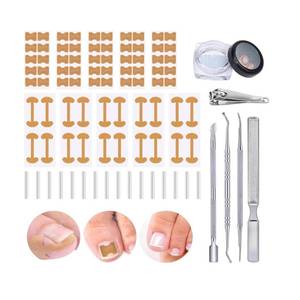 lot 12367 image: Professional Ingrown Toenail Set with Breathable Ingrown Toenail Strips, Curved Toenails Corrector Patch, Professional Pedicure Tools Kit for Ingrown Curved Toenails,Ingrown Toenail Removal Kit