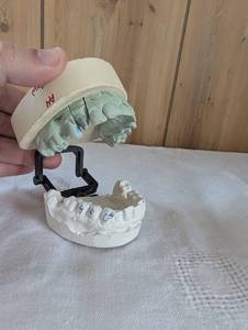 lot 1003 image: Dental Articulator with Upper and Lower Jaw Model