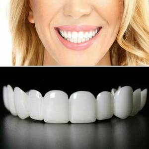 lot 14236 image: 2 Pairs, Temporarily Adjustable for Men and Women, Beautiful Smile
