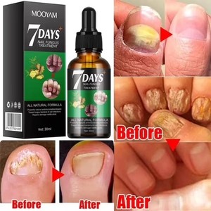 lot 65752 image: Mooyam Multi-Purpose Nail Repair Serum, Nail Solution for Discolored and Damaged Nails, 1 fl oz
