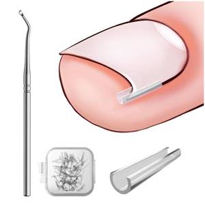 lot 14210 image: BEZOX Ingrown Toenail Corrector Set - 40 Pc