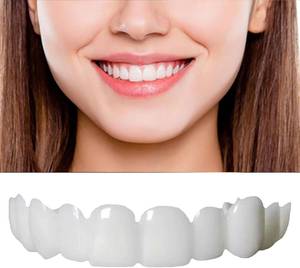 lot 3762 image: Temporary Smile Support 2 Pairs Adjustable All Genders UpperLower