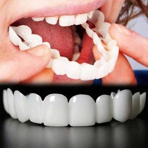 lot 1000 image: Generic Moldable Silicone Veneers Teeth Kit MB01