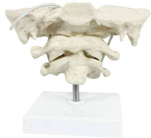 lot 8425 image: HEMIPLEGIA Cervical Spine Occipital Bone Atlas Axis Teaching Model 1.5X PVC