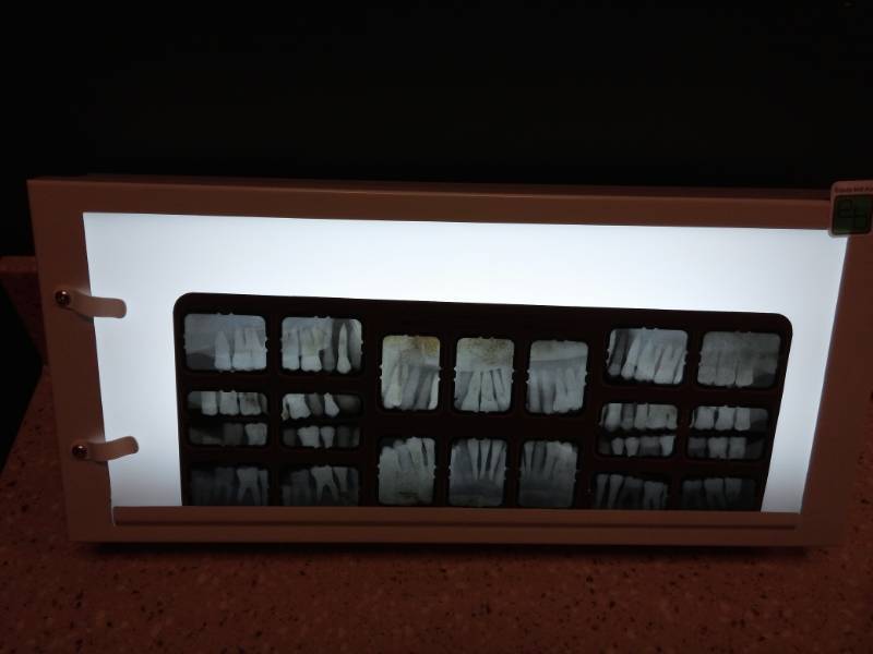 lot 3063 image: Henry Schein X-Ray Viewer Light Box
